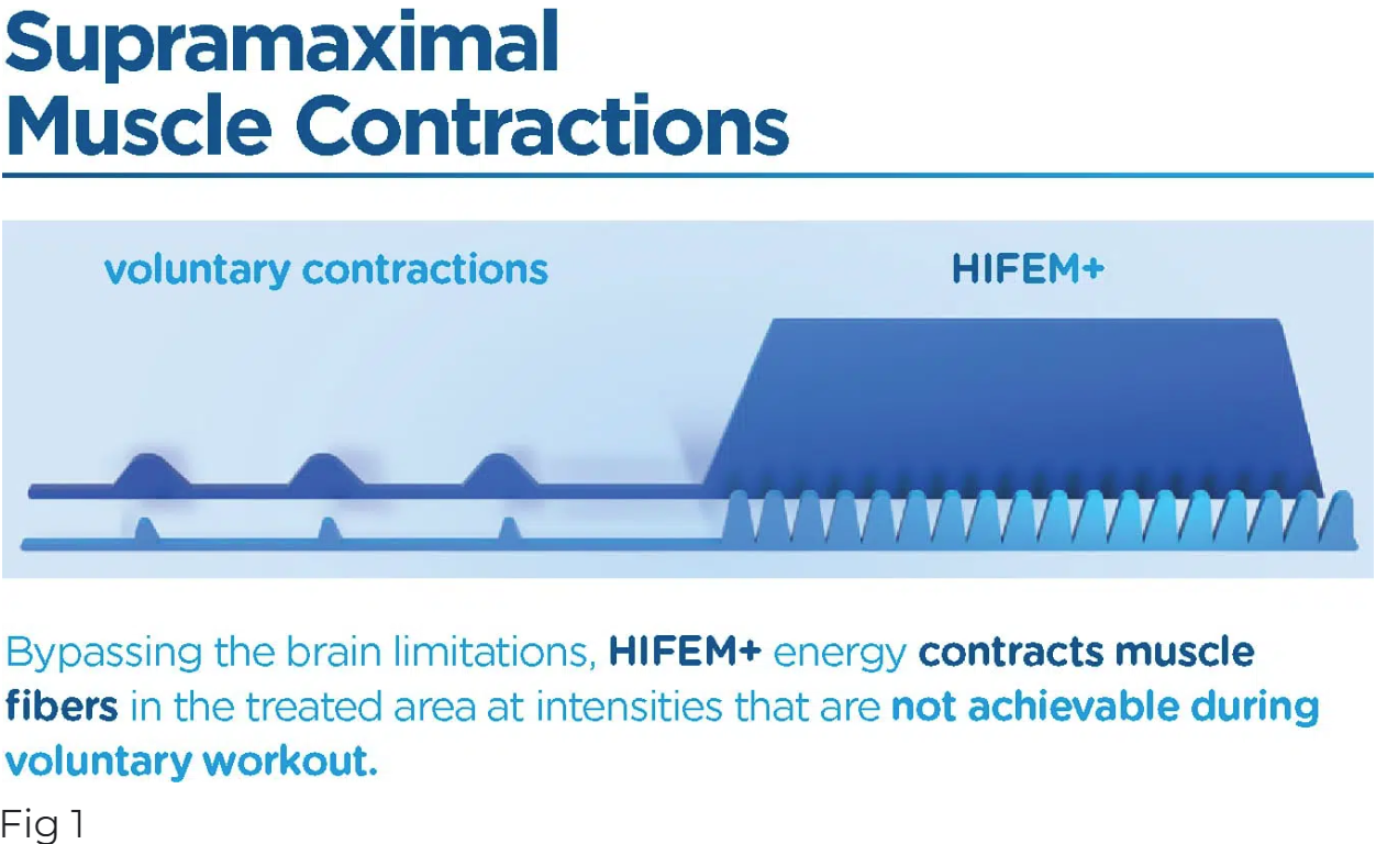 graphic-muscle-contractions